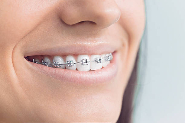 Best Dental Fillings (Composite and Amalgam)  in Fifth Ward, LA